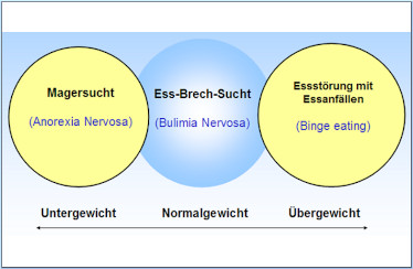 Schaubild Diagnosekriterien der Essstörungen