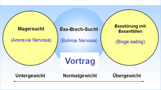 Schaubild Diagnosekriterien Essstörungen - Vortrag